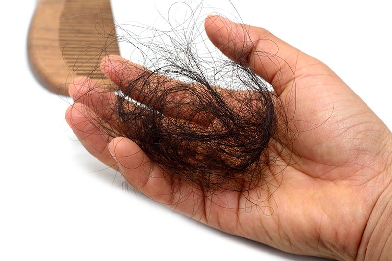 How Much Hair Loss is Normal?