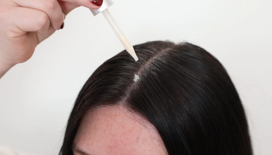 DHT and Hair Loss: What It Actually Does to Your Follicles