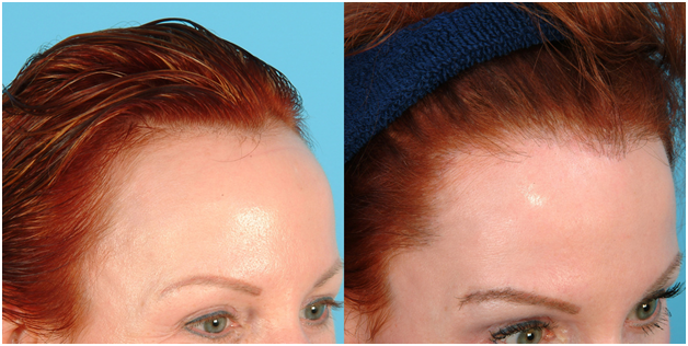 A Guide to Preventing Stress-Related Hair Loss