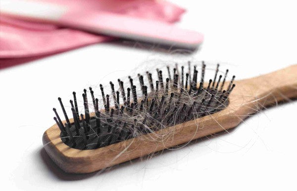 Receding Hairline: How to stop it?